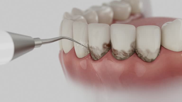 Reliable Wisdom Tooth Removal contractor in Forest County County, WI by Dentist Open Now